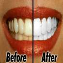 8 cách làm răng trắng hơn