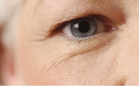 Người cao tuổi thường mắc những bệnh gì về mắt?
