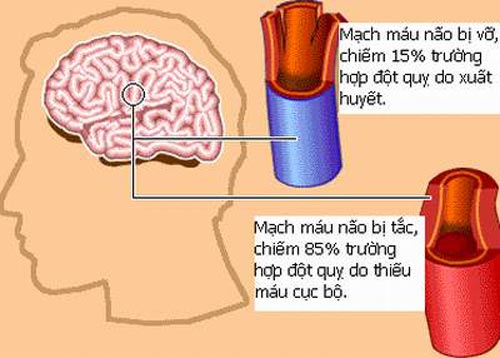 ăng lưu lượng tuần hoàn máu não giúp máu lưu thông lên não và tứ chi