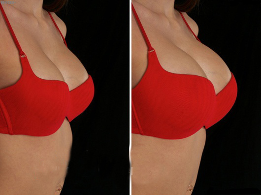 Bustbomb breast enlargement – viên uống nở ngực an toàn hiệu quả