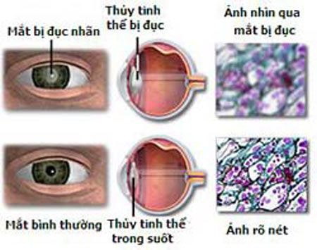 ocuvite adult 50+