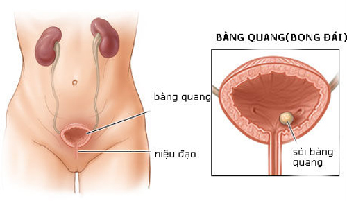 Chanca piedra – viên uống hỗ trợ điều trị sỏi thận 90 viên giải quyết các vấn đề sỏi thận và mật, cũng như các vấn đề khác liên quan đến tiết niệu