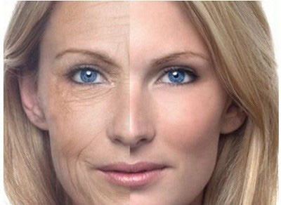 Neutrogena Anti-Wrinkle Daily Moisturizer 2