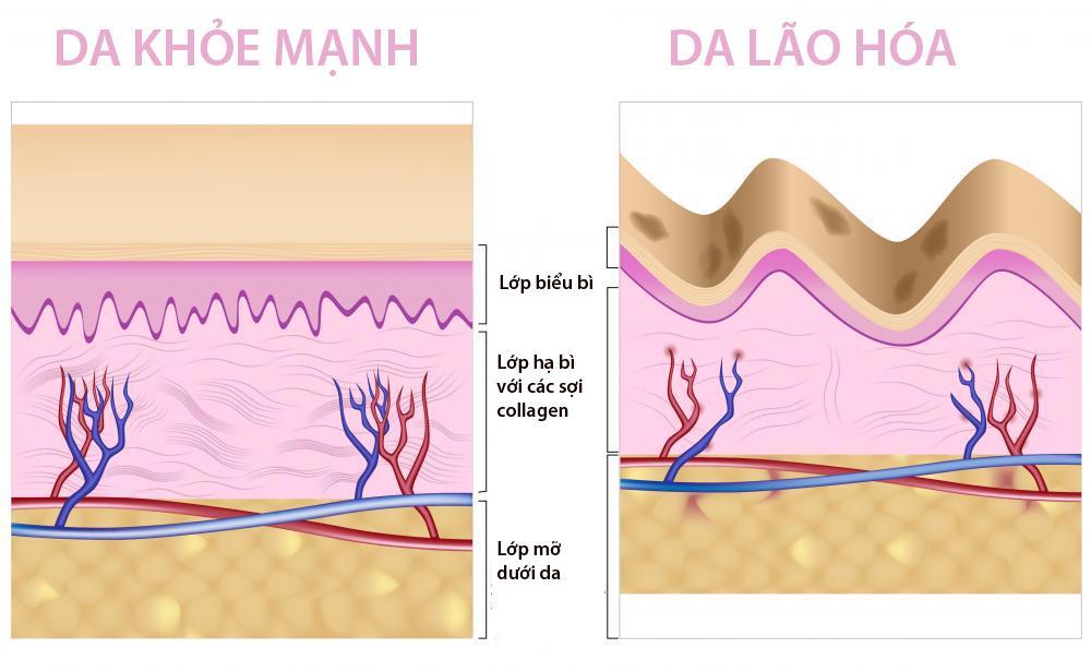 Cấu trúc Collagen quyết định sự mền mại, mịn màng hoặc thô ráp ở làn da của chính bạn