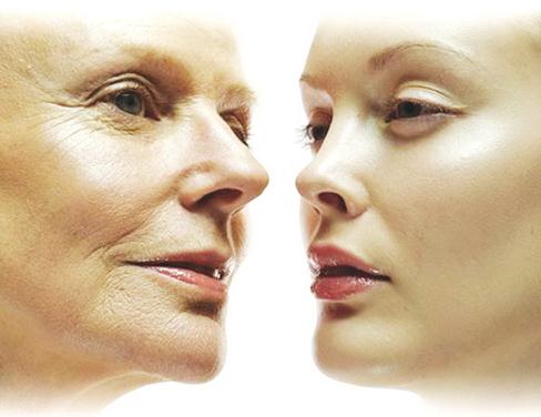 Nippi zokolazen drink collagen có trị nám không