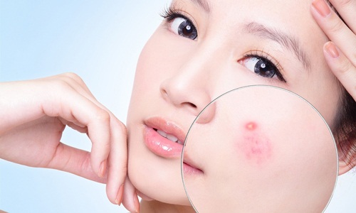Tác dụng nổi bật của tea tree oil facial cleanser