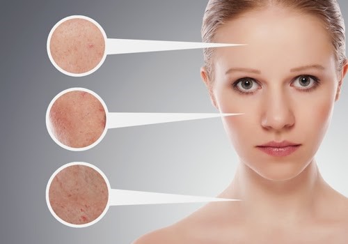 Công dụng của kem trị sẹo white doctors