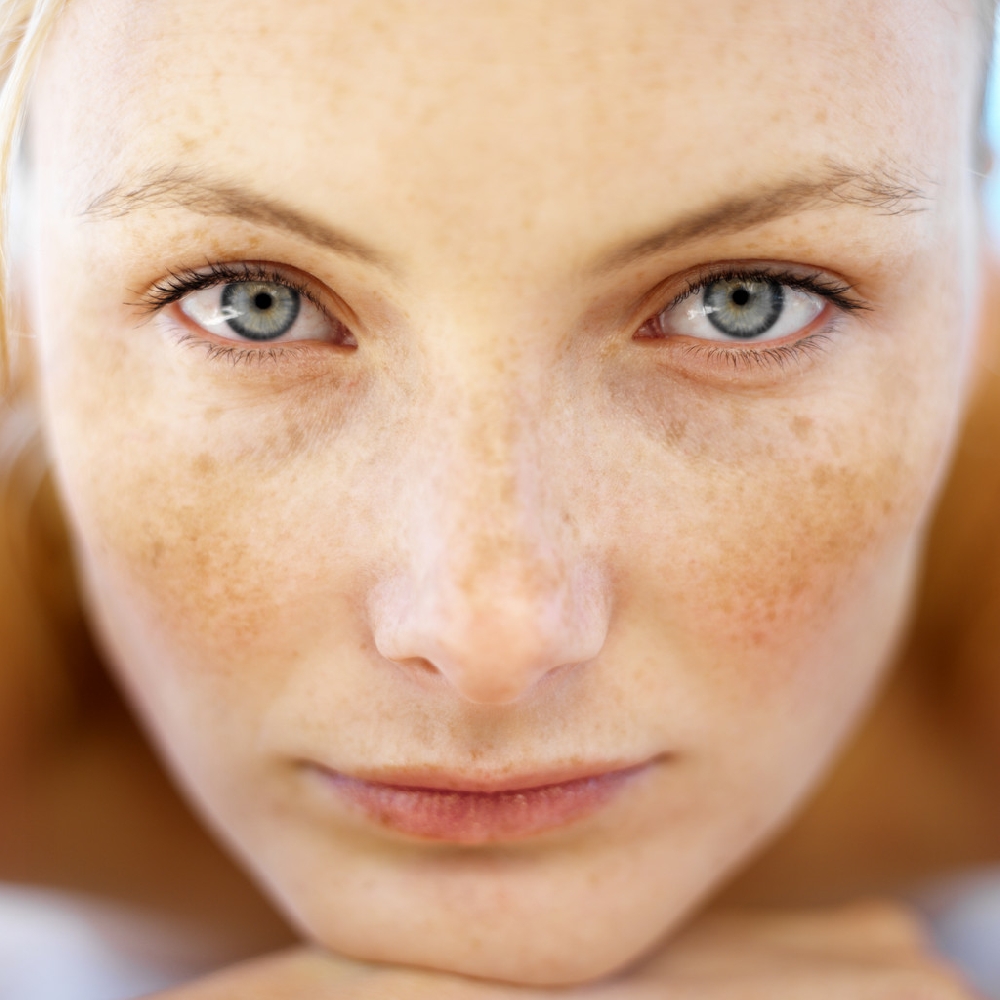 Công dụng của kem trị nám white doctors melasma pro