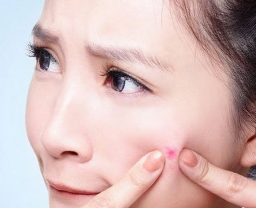 Công dụng của kem trị mụn shiseido pimplit