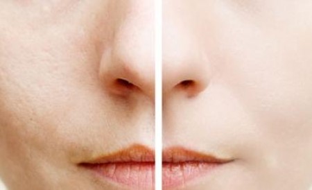 Đánh giá clinique dramatically different moisturizing cream