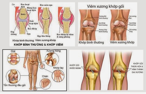 Viên uống xương khớp Arthri Flex Advance Viatmin D3 của Mỹ 180 viên hình 1