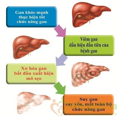 Công dụng của cây kế sữa milk thistle