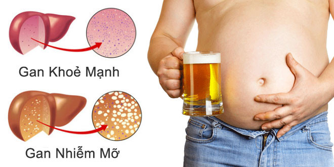 Viên uống chiết xuất từ nghệ nhật bản 30 viên: hỗ trợ chức năng gan