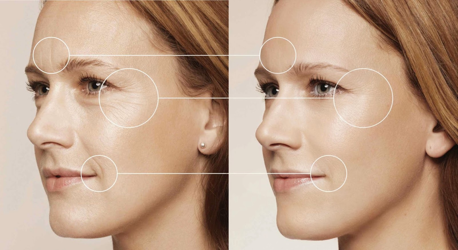 Viên uống chống lão hóa da hyaluron collagen 100 viên