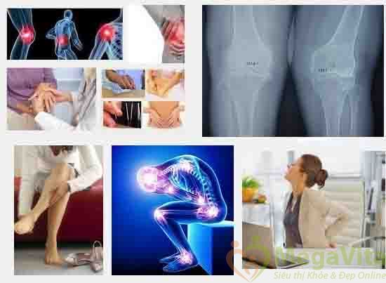 Viên uống bổ xương khớp glucosamine complex được chứng nhận an toàn thực phẩm của bộ y tế