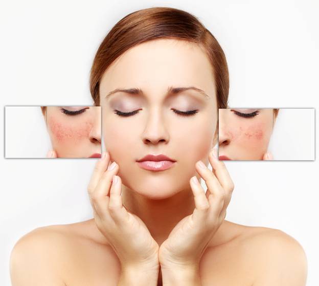 Thành phần kem trị tàn nhang trị nám nhau thai cừu rebirth