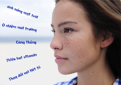 Viên uống đặc trị nám da nhật bản vita white plus c.e.b2 hộp 240 viên