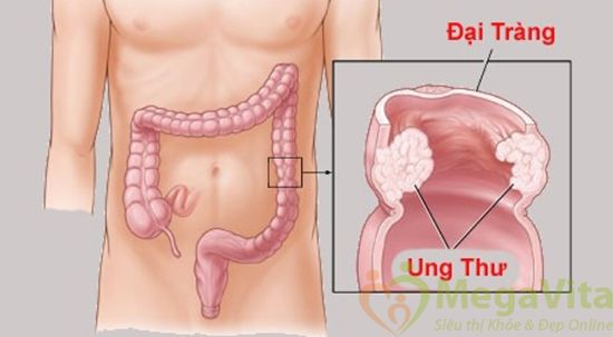 Thảo dược vỏ hạt mã Đề 42g