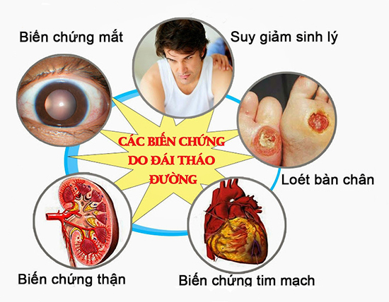 ViÊn uỐng ngĂn ngỪa vÀ hỖ trỢ ĐiỀu trỊ tiỂu ĐƯỜng puritan’s pride high potency diabetic support formular 60 viÊn