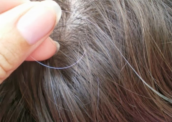 Thuốc trị bạc tóc sớm anti gray tốt như thế nào? 