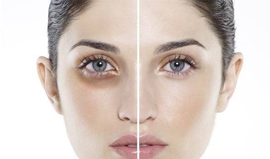 Viên bôi dưỡng da quanh mắt, trị quầng thâm mắt Jan Marini Age Intervention Dark Circle Eye Defense của Mỹ hộp 60 viên hình 1