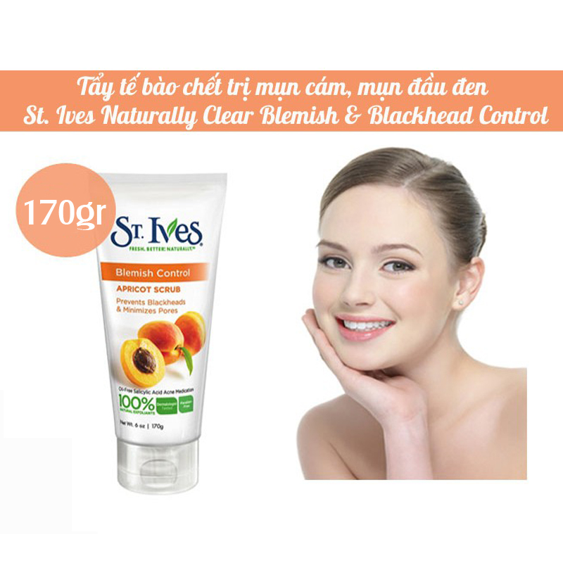 Sữa rửa mặt tẩy tế bào chết st.ives blemish control apricot scrub