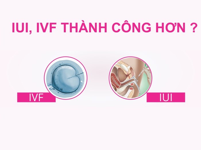 Myo-inositol for women and men: hỗ trợ điều hòa rụng trứng tự nhiên, tăng khả năng thụ thai tự nhiên, thích hợp cho người bệnh đa nang 120 viên